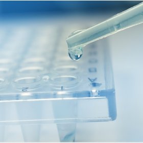 Κυτταρολογικά διαγνωστικά εργαστήρια Γκλίστη Ελένη - HPV Τεστ