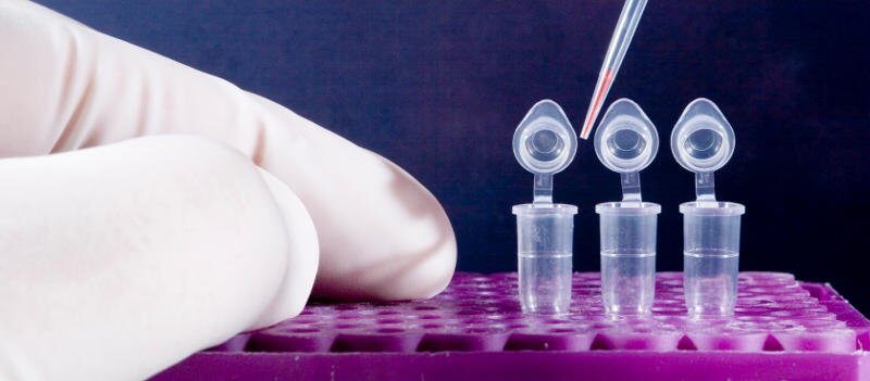 Κυτταρολογικά διαγνωστικά εργαστήρια Γκλίστη Ελένη - Εξέταση Πτυέλων