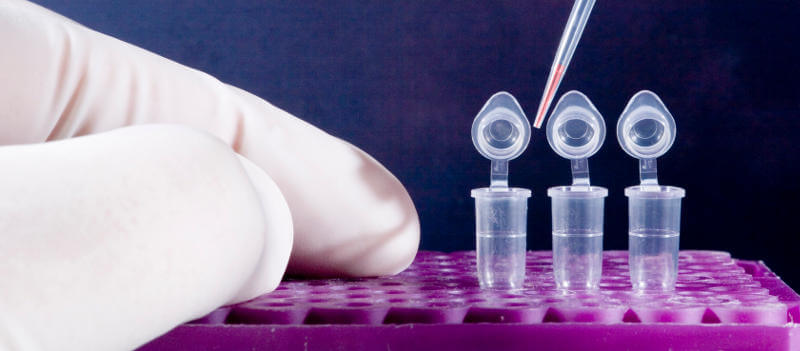 Κυτταρολογικά διαγνωστικά εργαστήρια Γκλίστη Ελένη - Εξέταση Πτυέλων